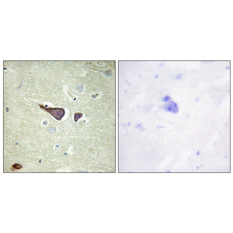 Immunohistochemistry - Anti-IGF2R Antibody (B1211) - Antibodies.com