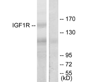 Western Blot - Anti-IGF1R Antibody (B7115) - Antibodies.com