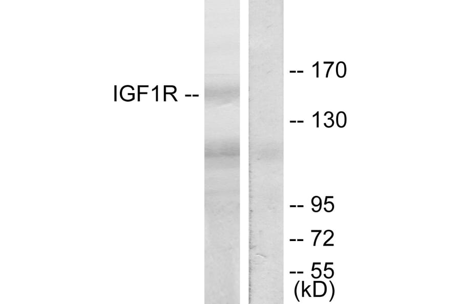 Western Blot - Anti-IGF1R Antibody (B7115) - Antibodies.com