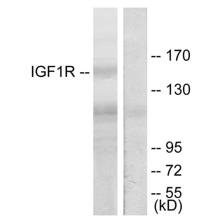 Western Blot - Anti-IGF1R Antibody (B7115) - Antibodies.com