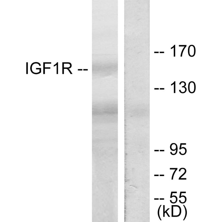 Western Blot - Anti-IGF1R Antibody (B7115) - Antibodies.com