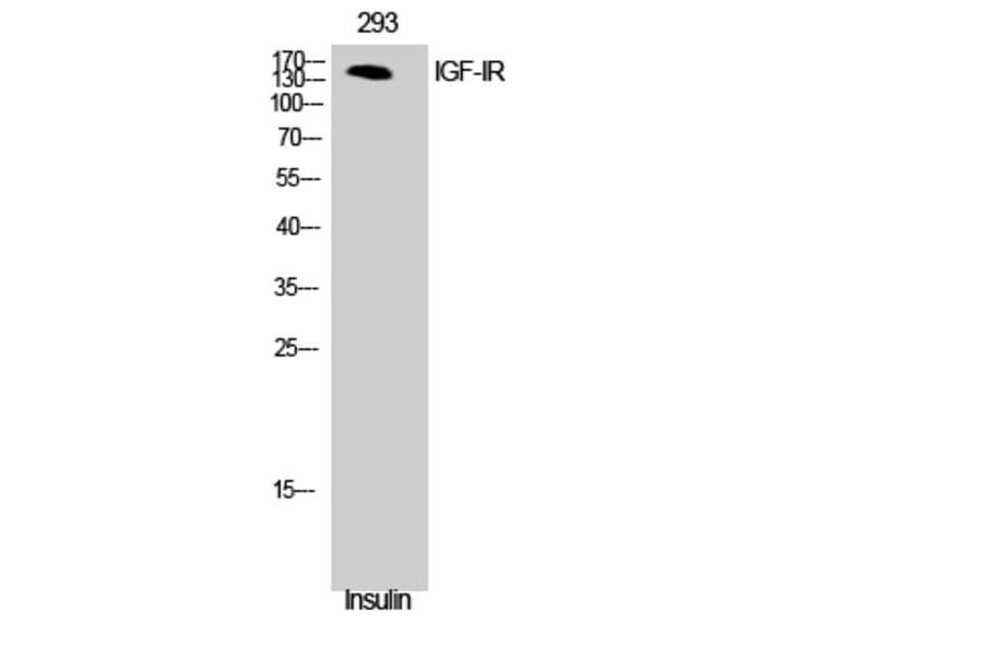 Western Blot - Anti-IGF1R Antibody (B7115) - Antibodies.com