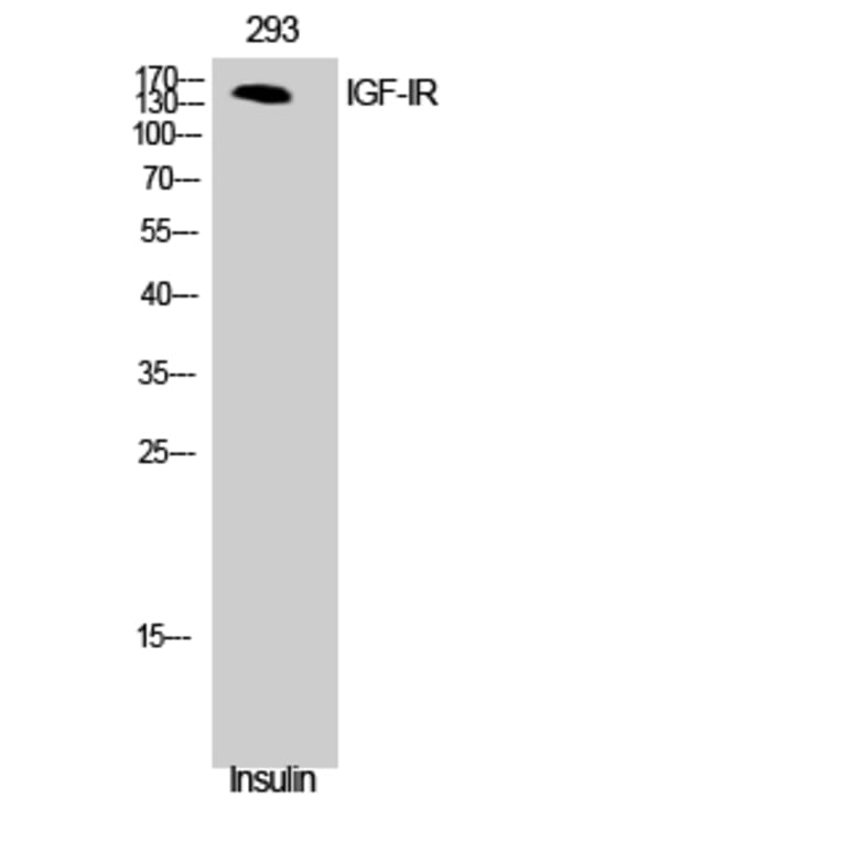 Western Blot - Anti-IGF1R Antibody (B7115) - Antibodies.com