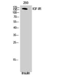 Western Blot - Anti-IGF1R Antibody (B7115) - Antibodies.com