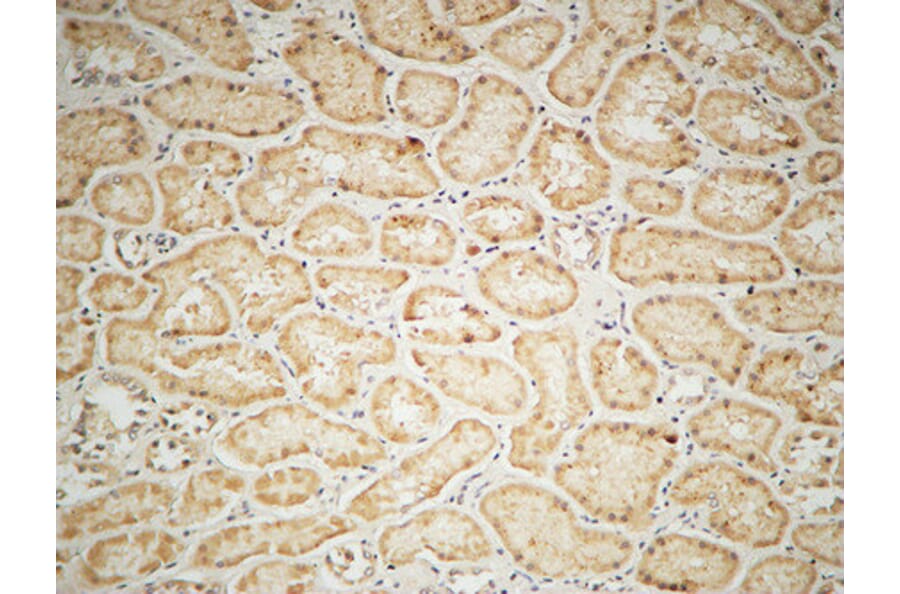 Immunohistochemistry - Anti-IGF1R Antibody (B7115) - Antibodies.com