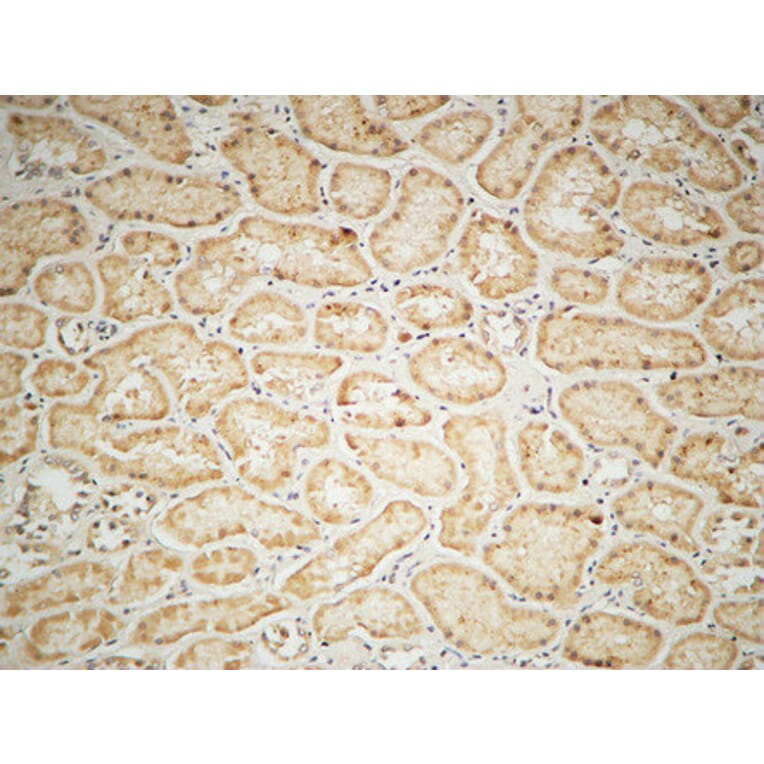 Immunohistochemistry - Anti-IGF1R Antibody (B7115) - Antibodies.com