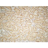 Immunohistochemistry - Anti-IGF1R Antibody (B7115) - Antibodies.com