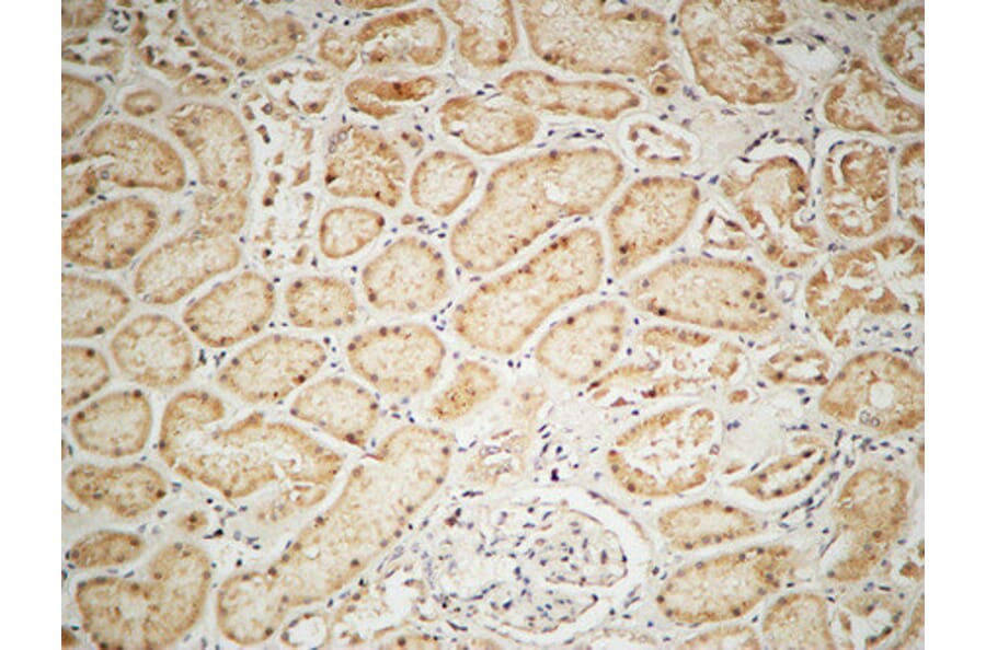 Immunohistochemistry - Anti-IGF1R Antibody (B7115) - Antibodies.com