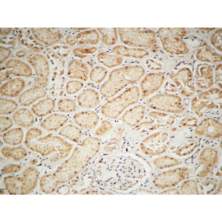 Immunohistochemistry - Anti-IGF1R Antibody (B7115) - Antibodies.com