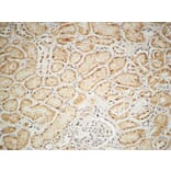 Immunohistochemistry - Anti-IGF1R Antibody (B7115) - Antibodies.com