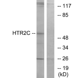 Western Blot - Anti-HTR2C Antibody (G008) - Antibodies.com