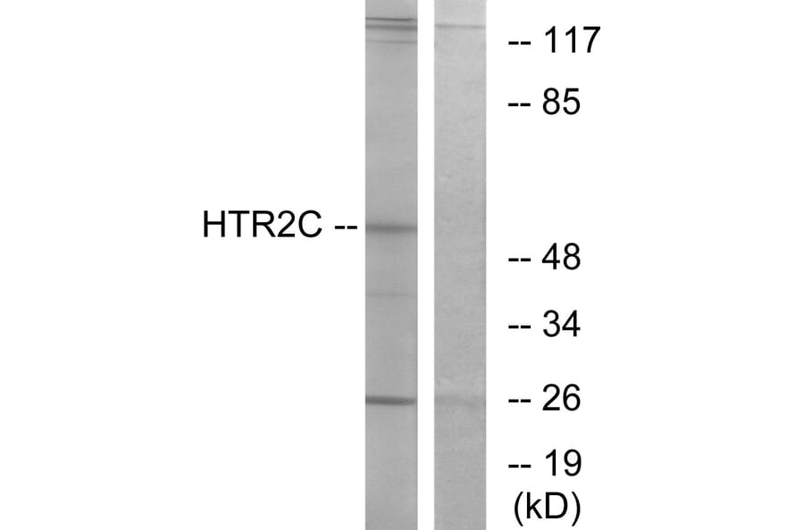 Western Blot - Anti-HTR2C Antibody (G008) - Antibodies.com