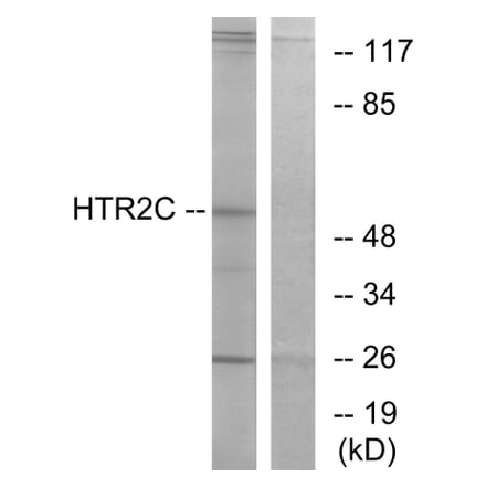 Western Blot - Anti-HTR2C Antibody (G008) - Antibodies.com