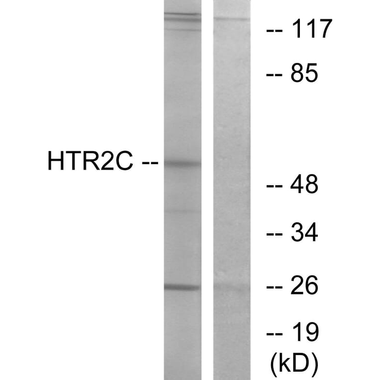Western Blot - Anti-HTR2C Antibody (G008) - Antibodies.com