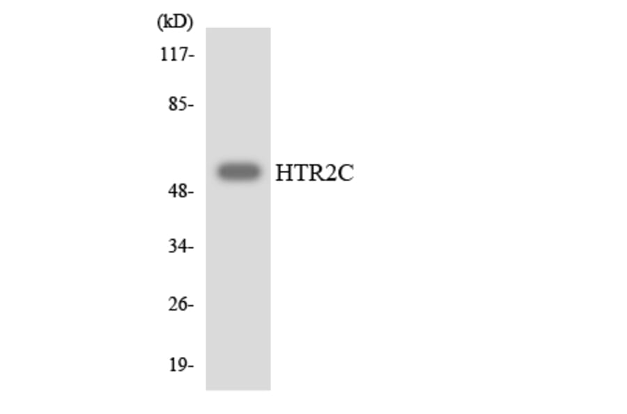 Western Blot - Anti-HTR2C Antibody (R12-2902) - Antibodies.com