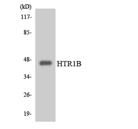 Western Blot - Anti-HTR1B Antibody (R12-2900) - Antibodies.com