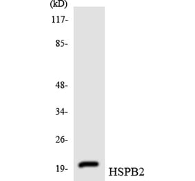 Western Blot - Anti-HSPB2 Antibody (R12-2899) - Antibodies.com