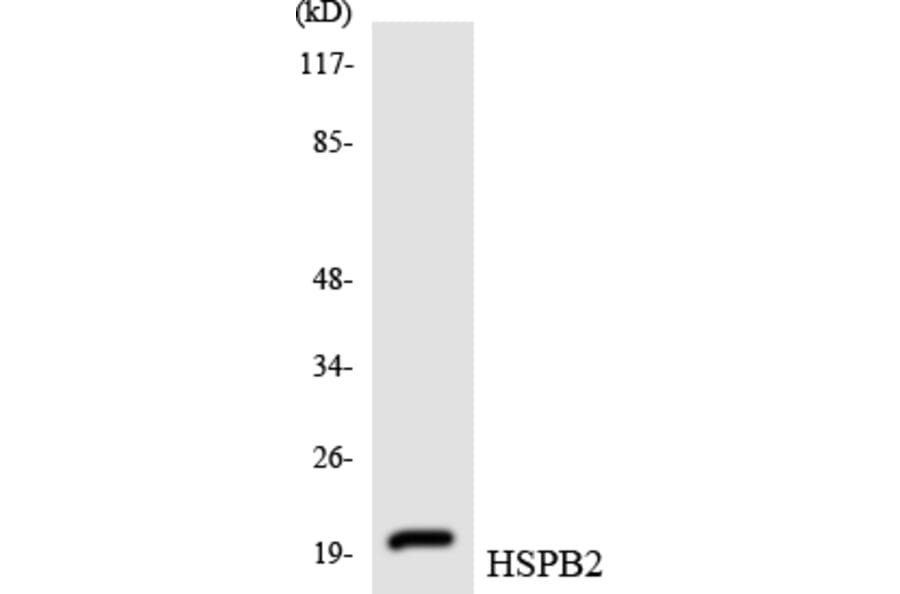 Western Blot - Anti-HSPB2 Antibody (R12-2899) - Antibodies.com