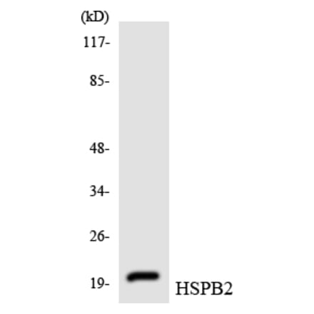 Western Blot - Anti-HSPB2 Antibody (R12-2899) - Antibodies.com