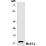 Western Blot - Anti-HSPB2 Antibody (R12-2899) - Antibodies.com