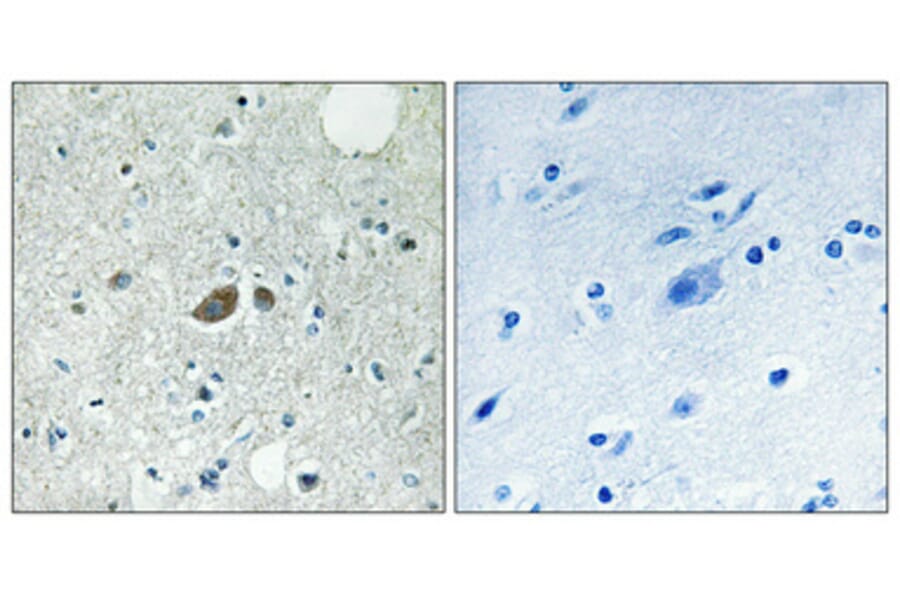 Immunohistochemistry - Anti-HSP7E Antibody (C12417) - Antibodies.com
