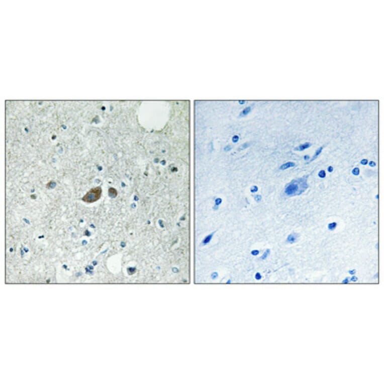 Immunohistochemistry - Anti-HSP7E Antibody (C12417) - Antibodies.com