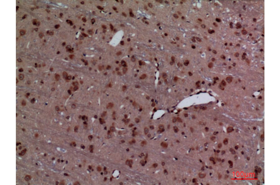 Immunohistochemistry - Anti-HOXD3 Antibody (C30129) - Antibodies.com
