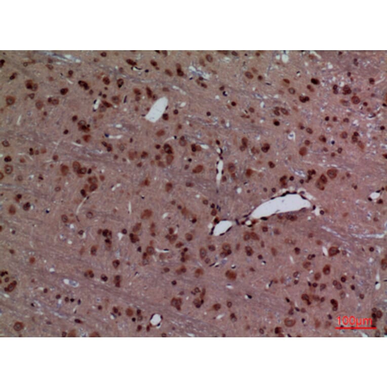 Immunohistochemistry - Anti-HOXD3 Antibody (C30129) - Antibodies.com