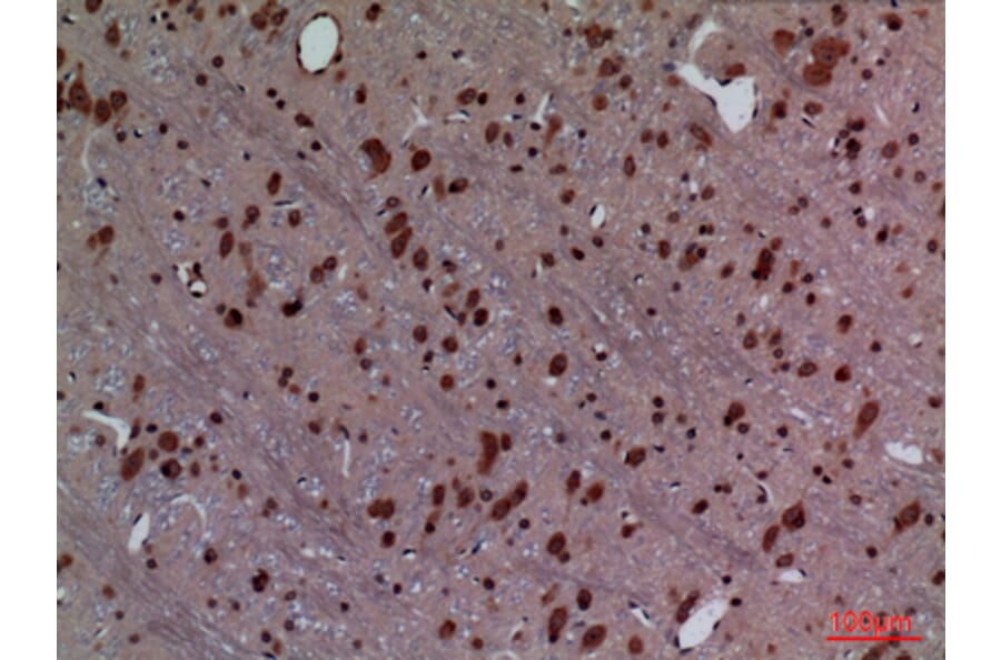 Immunohistochemistry - Anti-HOXD3 Antibody (C30129) - Antibodies.com