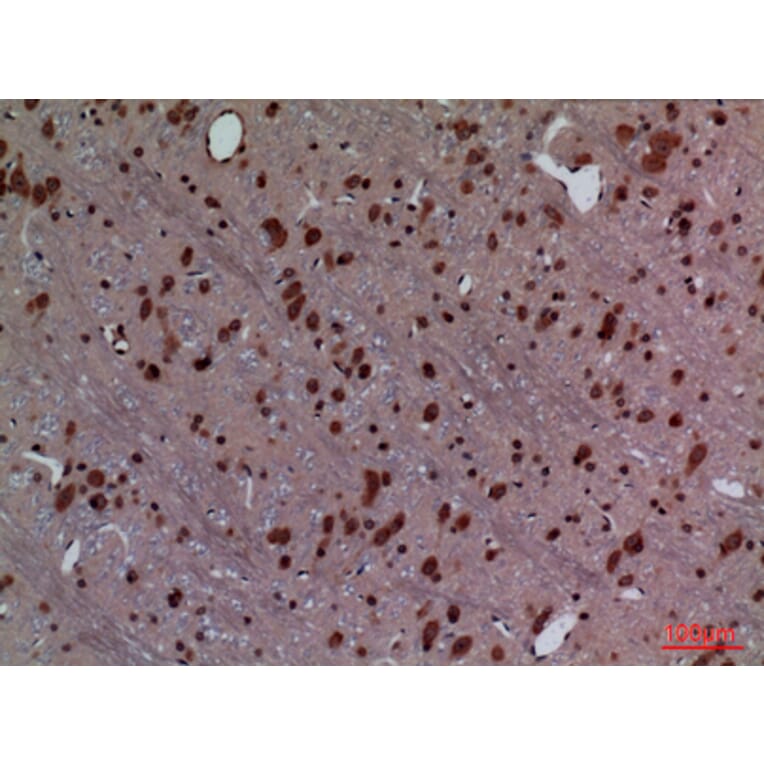 Immunohistochemistry - Anti-HOXD3 Antibody (C30129) - Antibodies.com