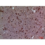 Immunohistochemistry - Anti-HOXD3 Antibody (C30129) - Antibodies.com