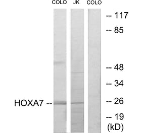 Western Blot - Anti-HOXA7 Antibody (C10524) - Antibodies.com