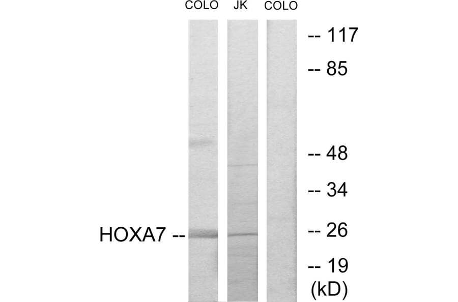 Western Blot - Anti-HOXA7 Antibody (C10524) - Antibodies.com