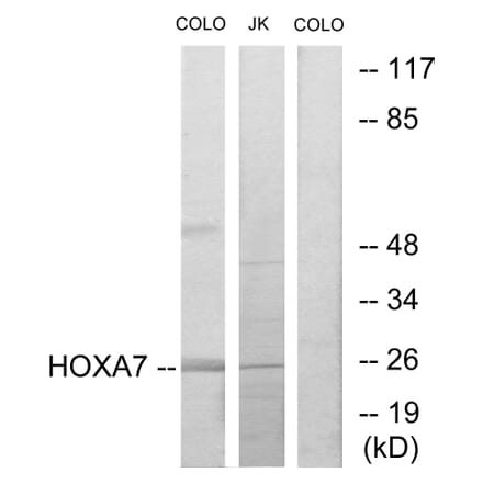 Western Blot - Anti-HOXA7 Antibody (C10524) - Antibodies.com