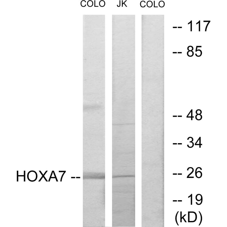 Western Blot - Anti-HOXA7 Antibody (C10524) - Antibodies.com
