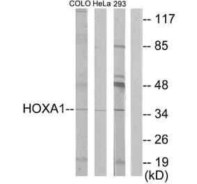 Western Blot - Anti-HOXA1 Antibody (C10645) - Antibodies.com