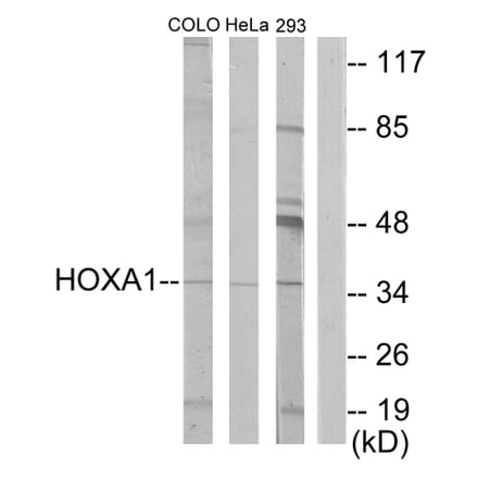 Western Blot - Anti-HOXA1 Antibody (C10645) - Antibodies.com