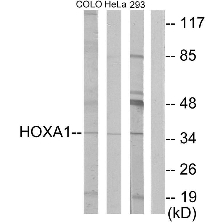Western Blot - Anti-HOXA1 Antibody (C10645) - Antibodies.com