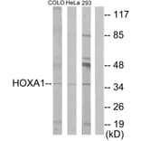 Western Blot - Anti-HOXA1 Antibody (C10645) - Antibodies.com