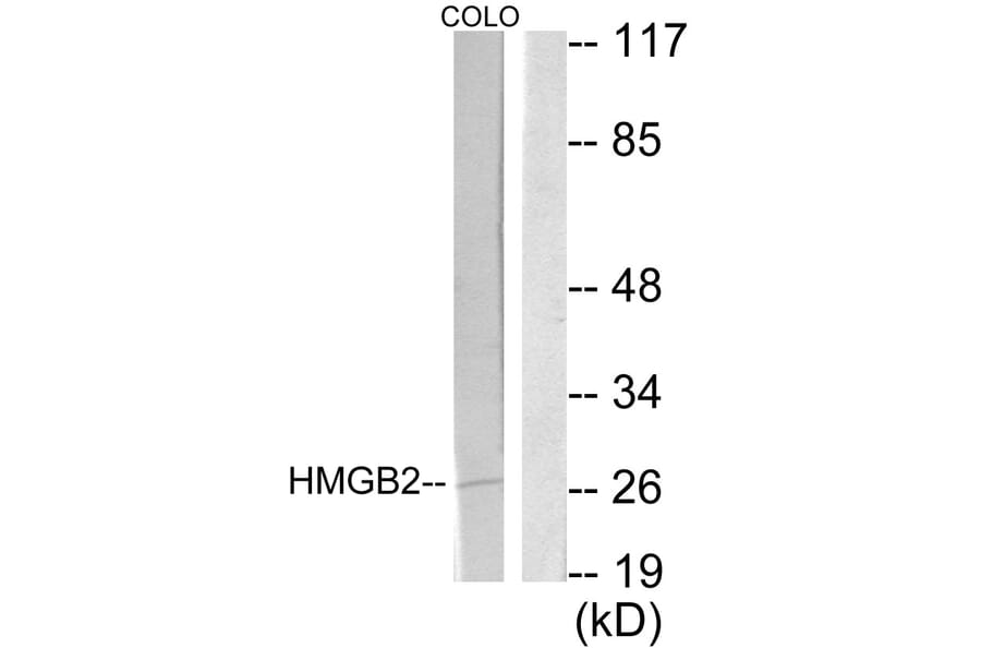 Western Blot - Anti-HMGB2 Antibody (C10487) - Antibodies.com