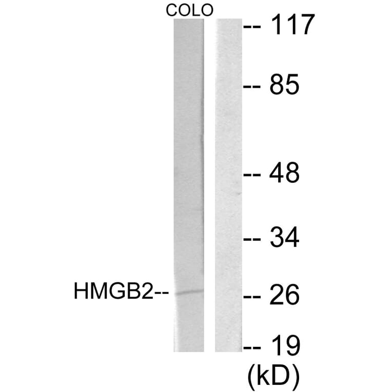 Western Blot - Anti-HMGB2 Antibody (C10487) - Antibodies.com