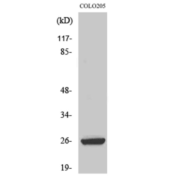 Western Blot - Anti-HMGB2 Antibody (C10487) - Antibodies.com