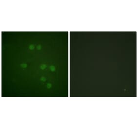 Immunofluorescence - Anti-HMG14 Antibody (B1040) - Antibodies.com