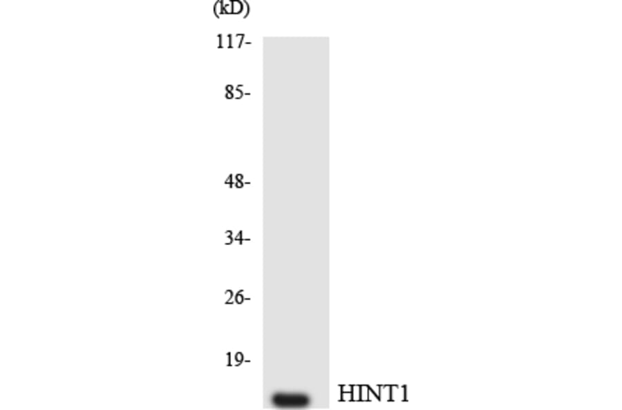 Western Blot - Anti-HINT1 Antibody (R12-2877) - Antibodies.com