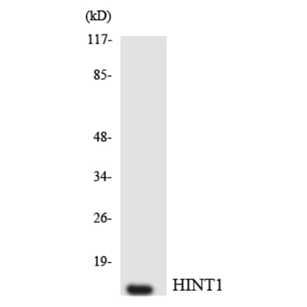 Western Blot - Anti-HINT1 Antibody (R12-2877) - Antibodies.com