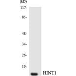 Western Blot - Anti-HINT1 Antibody (R12-2877) - Antibodies.com