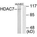 Western Blot - Anti-HDAC7 Antibody (C0227) - Antibodies.com