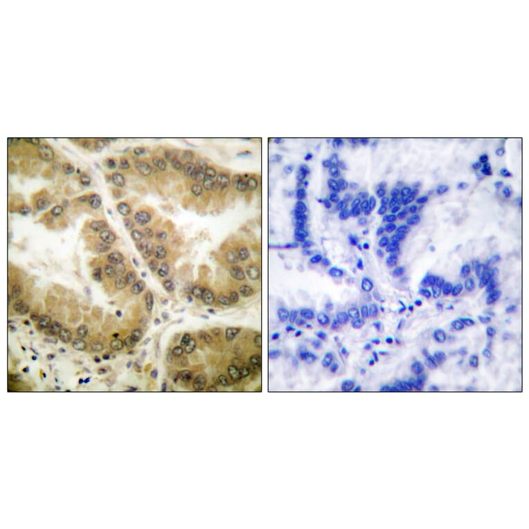 Immunohistochemistry - Anti-HDAC7 Antibody (C0227) - Antibodies.com