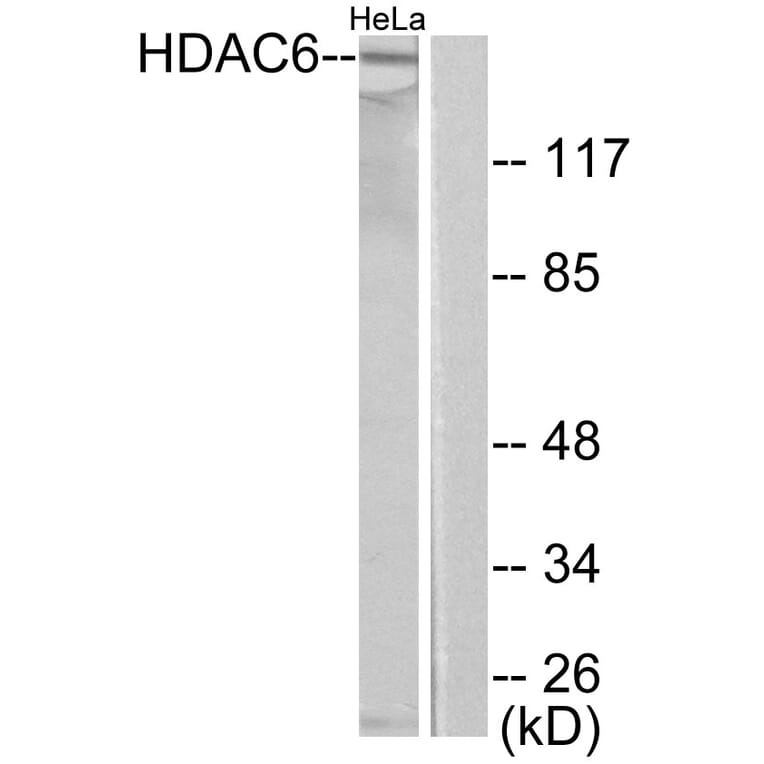 Western Blot - Anti-HDAC6 Antibody (C0226) - Antibodies.com