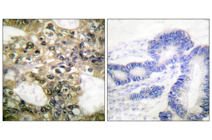 Immunohistochemistry - Anti-HDAC6 Antibody (C0226) - Antibodies.com
